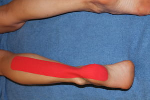 First step in achilles tendon kinesiology taping technique