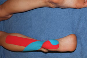 Second step in achilles tendon kinesiology taping technique