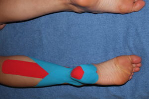 Final step in achilles tendon kinesiology taping technique